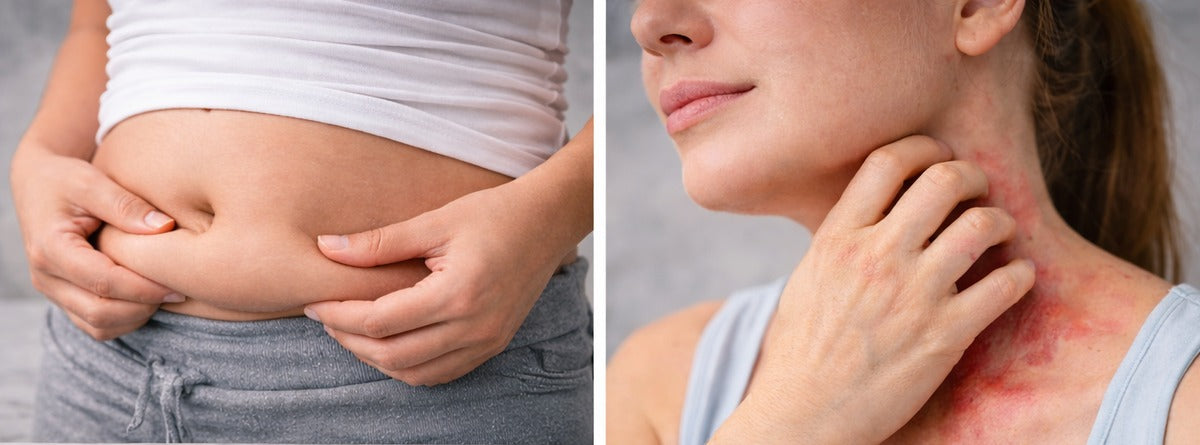 Kollagen Nebenwirkungen